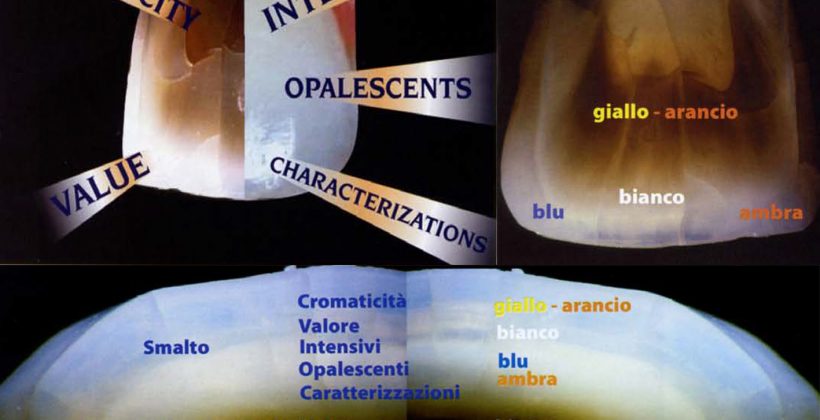Estetica in odontoiatria Il colore dei denti