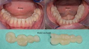 odontoiatria-mini-invasiva