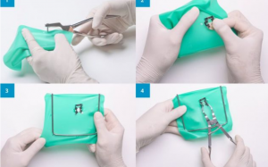 La diga di gomma  un ausilio imprescindibile per una odontoiatria di qualità.