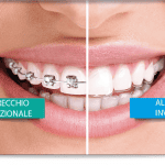 Le mascherine invisibili