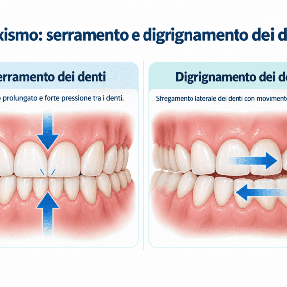 Il Bruxismo – Dalla Diagnosi alle Strategie di Gestione