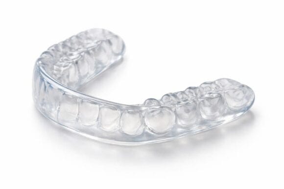 Bite occlusale personalizzato per la protezione dei denti
